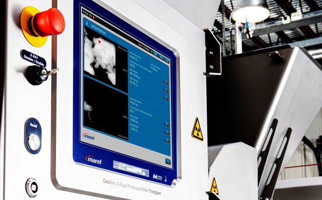 SensorX Magna X-ray bone detection displayed on screen